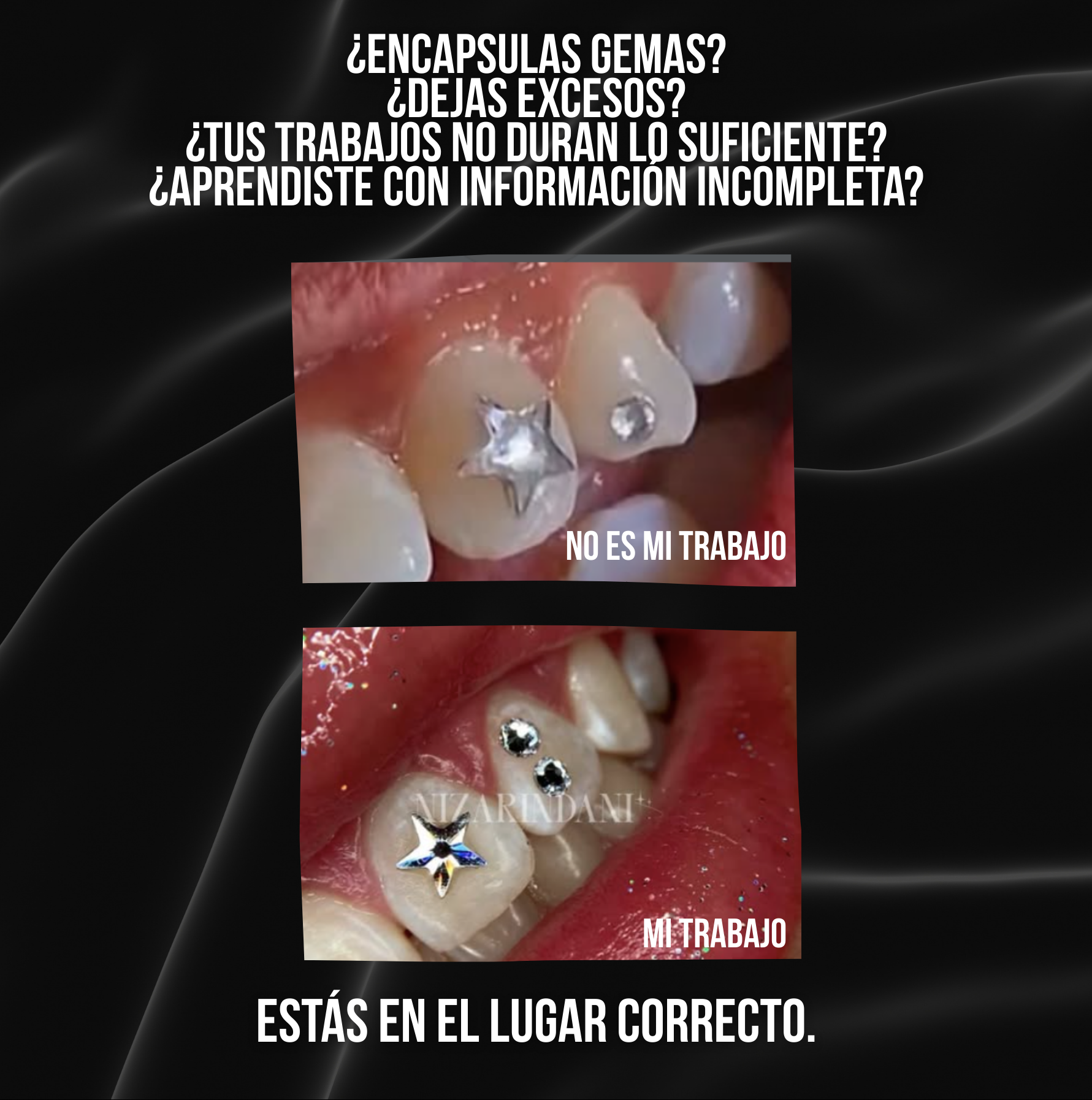Actualización de Joyería Dental