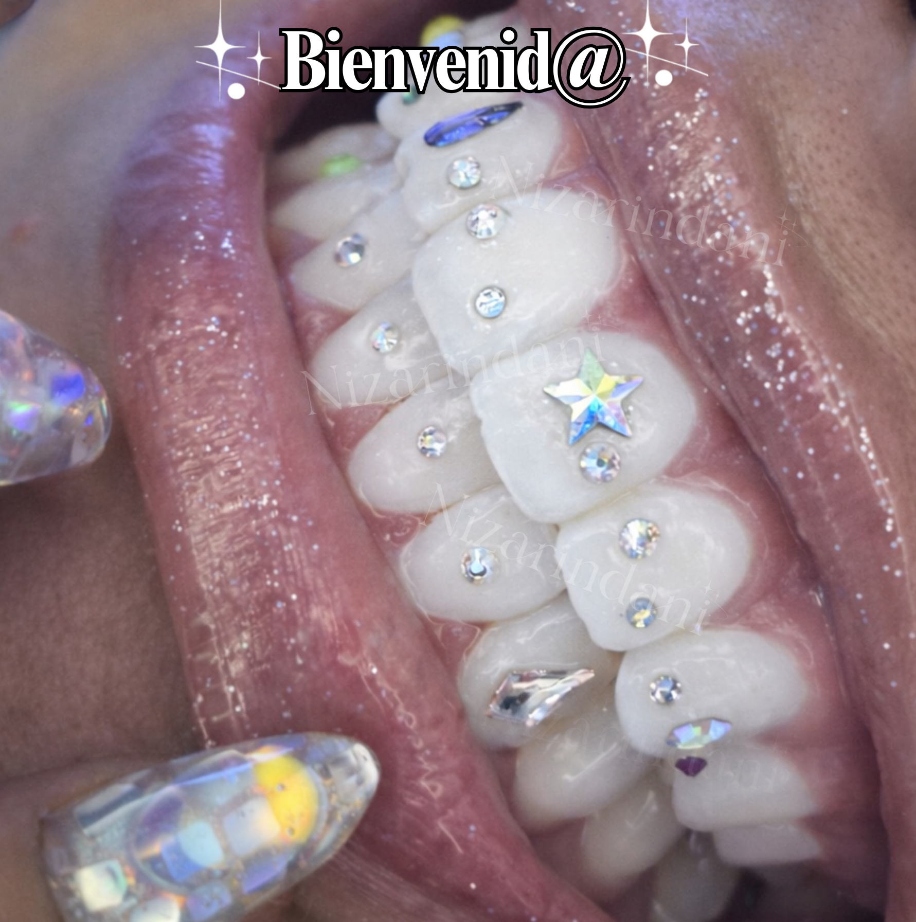 Actualización de Joyería Dental