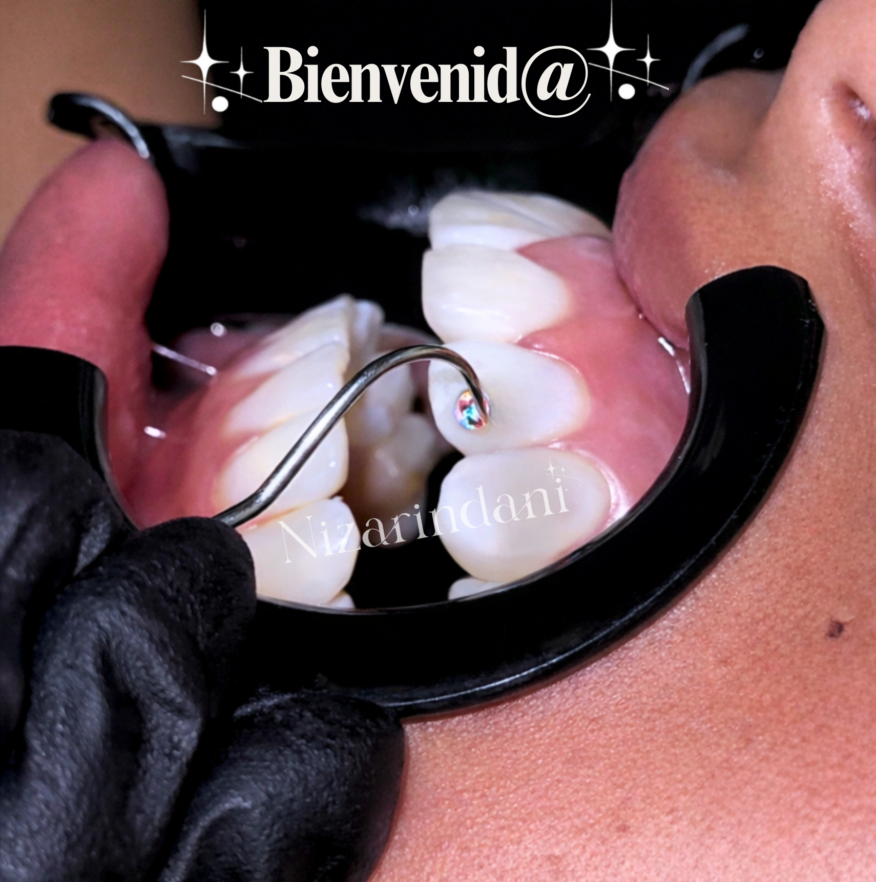 Curso Presencial de Joyería Dental